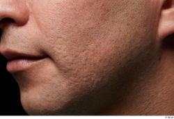 Face Mouth Cheek Skin Man Scar Slim Studio photo references